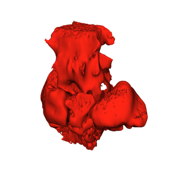 Ct Scan To 3D